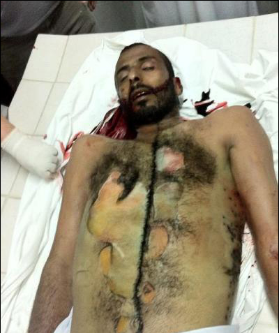 Bahraini al-Khalifa Forces Brutally Kill a Protester Salah Abbas