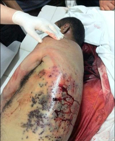 Bahraini al-Khalifa Forces Brutally Kill a Protester Salah Abbas